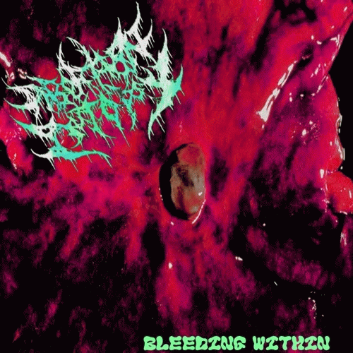 Abortion Autopsy : Bleeding Within